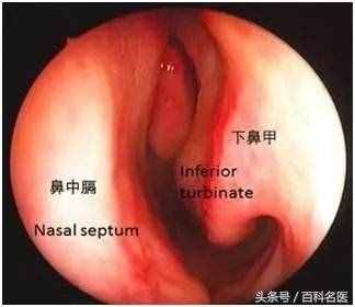 鼻子總是不通氣？別大意！可能是這6種疾病的征兆！