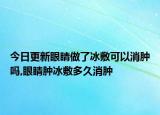 今日更新眼睛做了冰敷可以消腫嗎,眼睛腫冰敷多久消腫