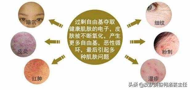 天天在說(shuō)抗氧化，抗氧化到底是什么？大多數(shù)人沒(méi)搞懂它