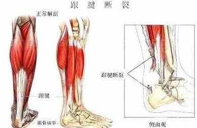 常見的幾種足底疼痛，哪些原因引起的呢？