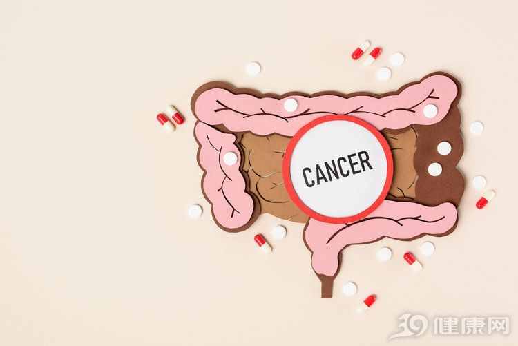 得了大腸癌，身體有哪些癥狀？2個信號，很多人沒看清
