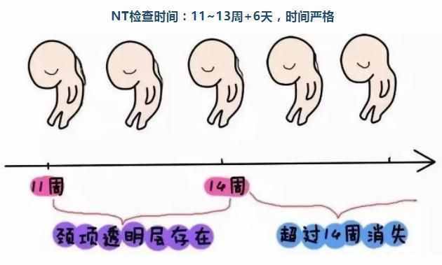 什么是NT檢查、懷孕多少周做、結(jié)果異常咋辦，10個(gè)問題帶你了解NT