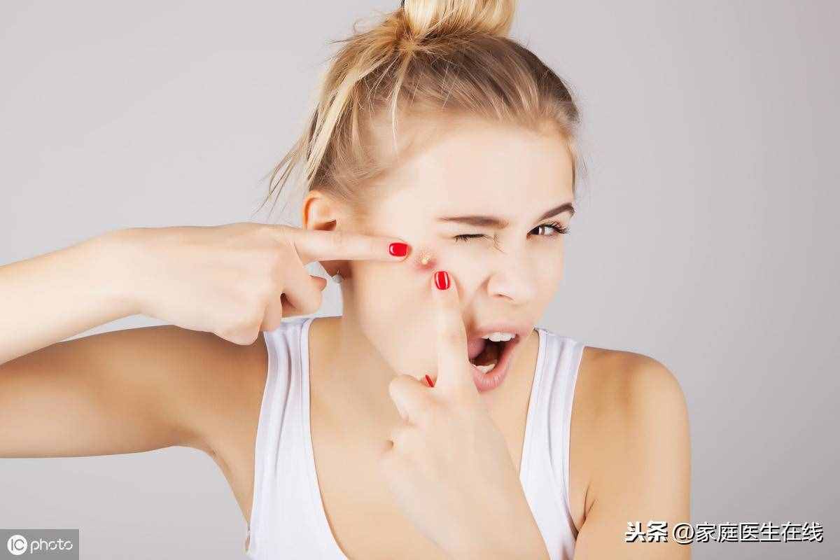 如何能“消滅”青春痘？皮膚專家教你幾招，讓你“戰(zhàn)痘”到底