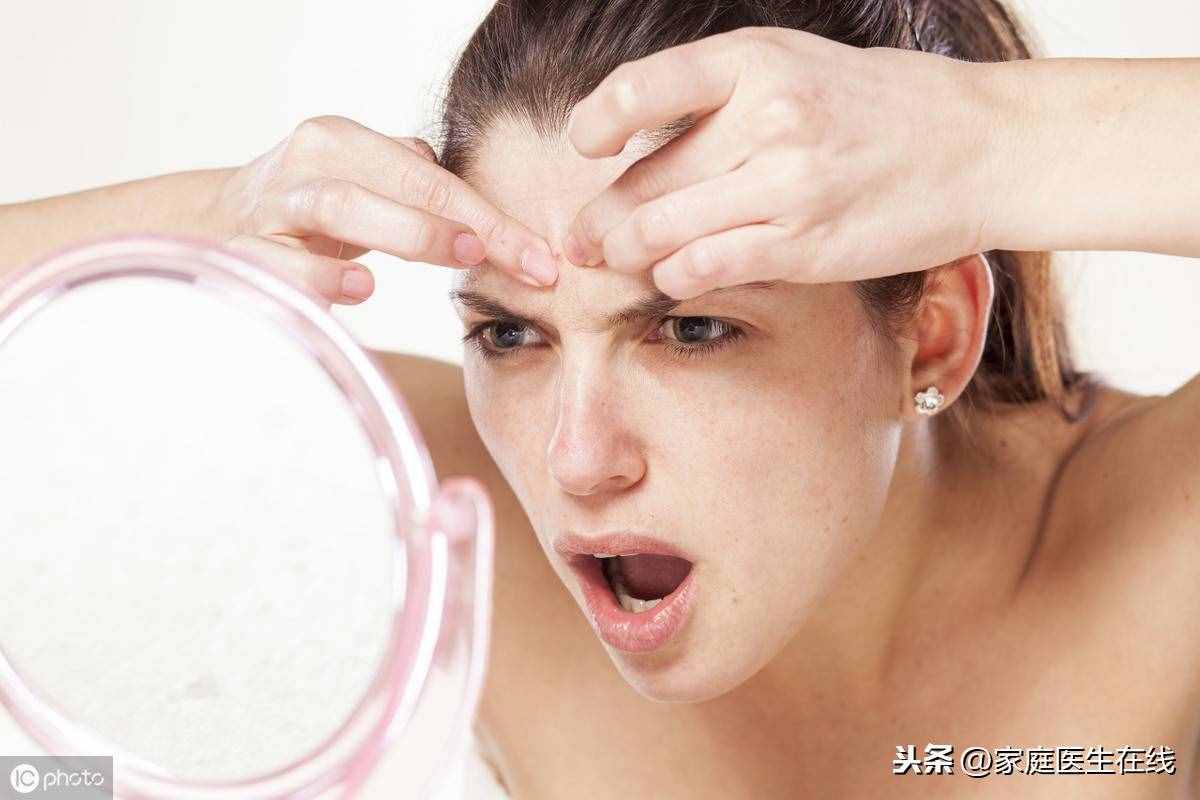 如何能“消滅”青春痘？皮膚專家教你幾招，讓你“戰(zhàn)痘”到底