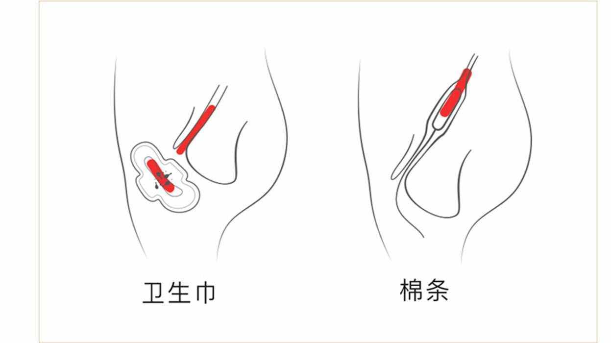 衛(wèi)生棉條的正確使用方法