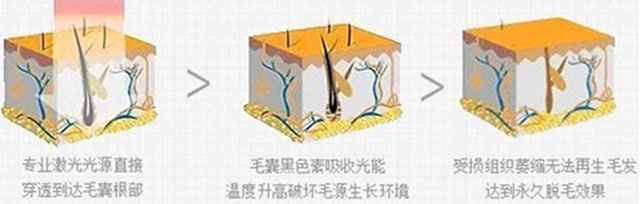 一根棉線擔當?shù)拿撁吧衿鳌保?class=