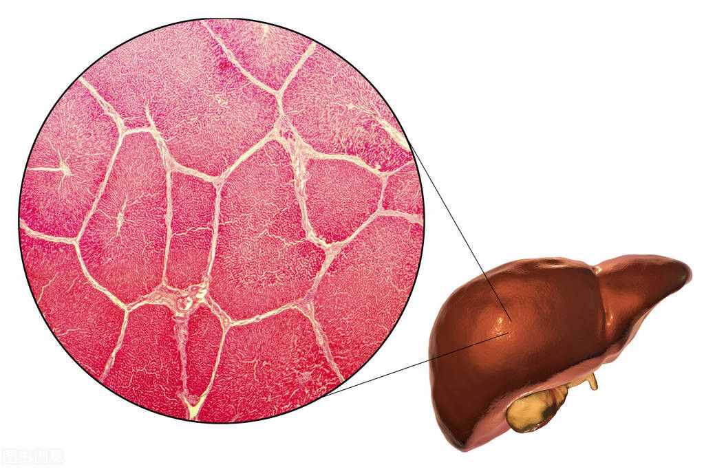 肝硬化一般壽命有多長？1年、2年還是多久？一文全知曉，漲知識