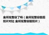 金所炫整容了嗎（金所炫整容前后照片對(duì)比 金所炫整容前照片）