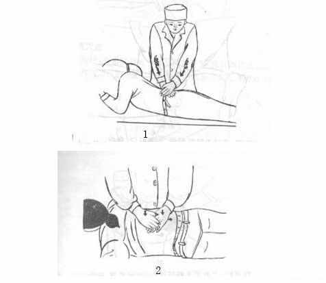 真?zhèn)饕痪湓?，假傳萬卷書！分享3種日常常用的推拿手法真?zhèn)?class=