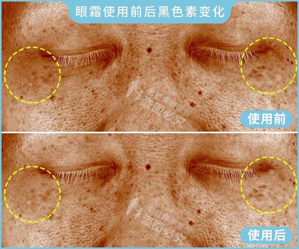 眼霜真的對黑眼圈、細紋有效嗎？1個月跟蹤實測結果來了