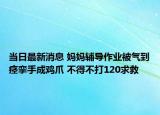 當(dāng)日最新消息 媽媽輔導(dǎo)作業(yè)被氣到痙攣手成雞爪 不得不打120求救