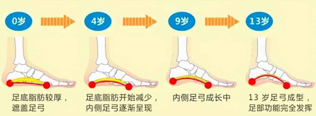 扁平足——有一種痛叫做“腳踏實(shí)地”的痛