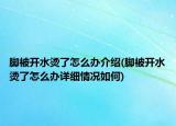 腳被開水燙了怎么辦介紹(腳被開水燙了怎么辦詳細(xì)情況如何)