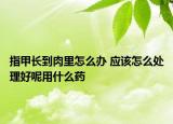 指甲長到肉里怎么辦 應(yīng)該怎么處理好呢用什么藥