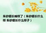 朱砂痣長啥樣了（朱砂痣長什么樣 朱砂痣長什么樣子）